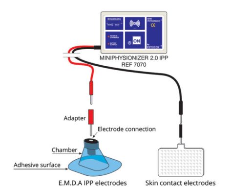 The EMDA® system consists of an electrical generator and therapeutic and dispersive electrodes.